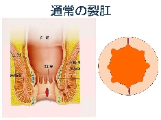 スライド4.JPG