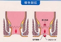 裂イラスト２.jpg