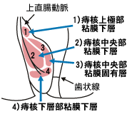 ジオン注３.gif