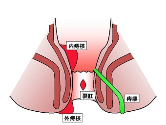 肛門図.jpg